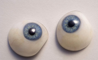 人工眼和眼眶植入物是什么？义眼定制告诉你
