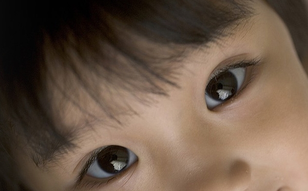 安装义眼片会影响儿童眼部发育吗