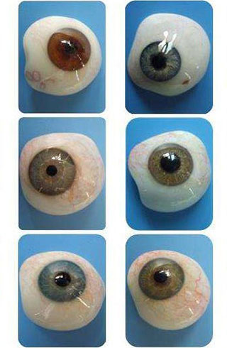 使用半定制假体修复患有眼部缺损的患者