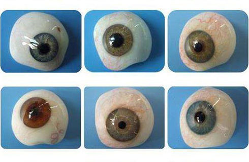 假眼患者事项的事项及义眼片被认可的原因
